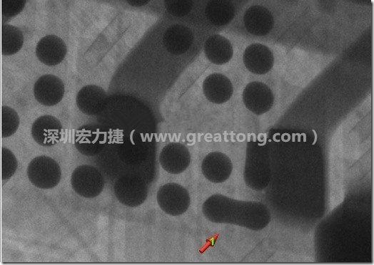 BGA因?yàn)楹笁|變小，造成錫膏過多而最終形成焊接短路的結(jié)果。